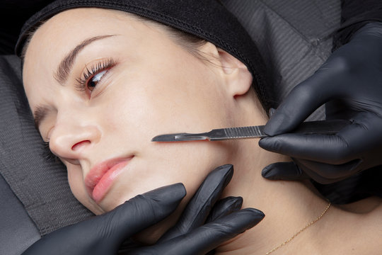 Smooth Skin Dermaplaning Service in Lighthouse Point - Doctor performing dermaplaning on woman's face
