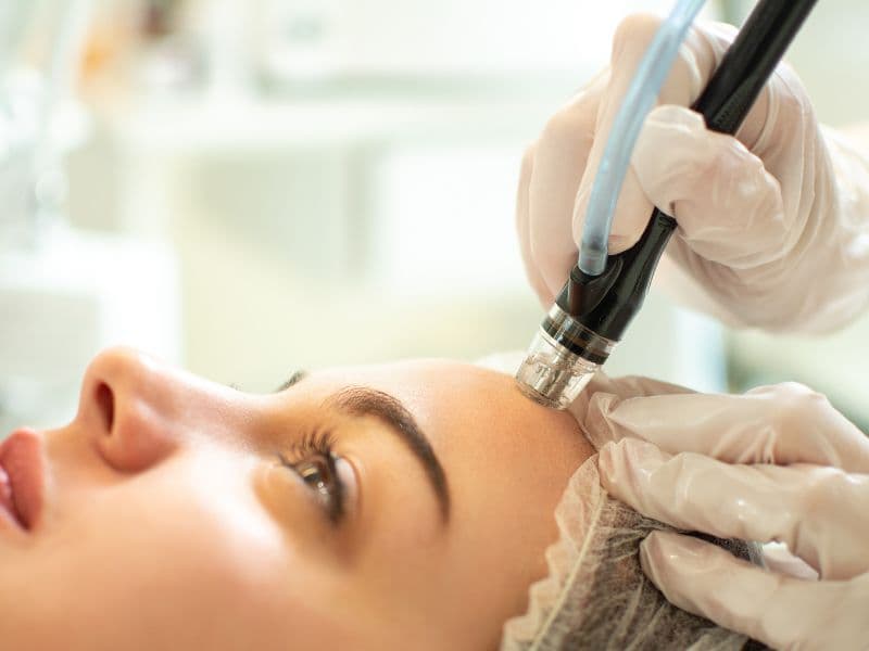 hydrafacial treatment