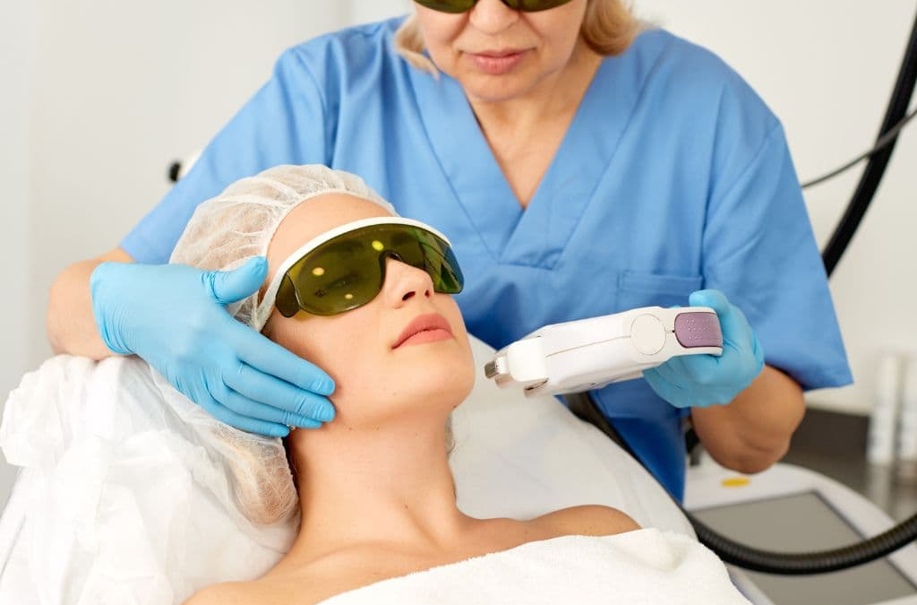laser hair removal on chin