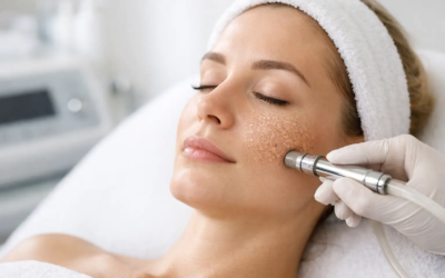 Microdermabrasion for Rough Texture