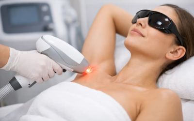 How Laser Hair Removal Works