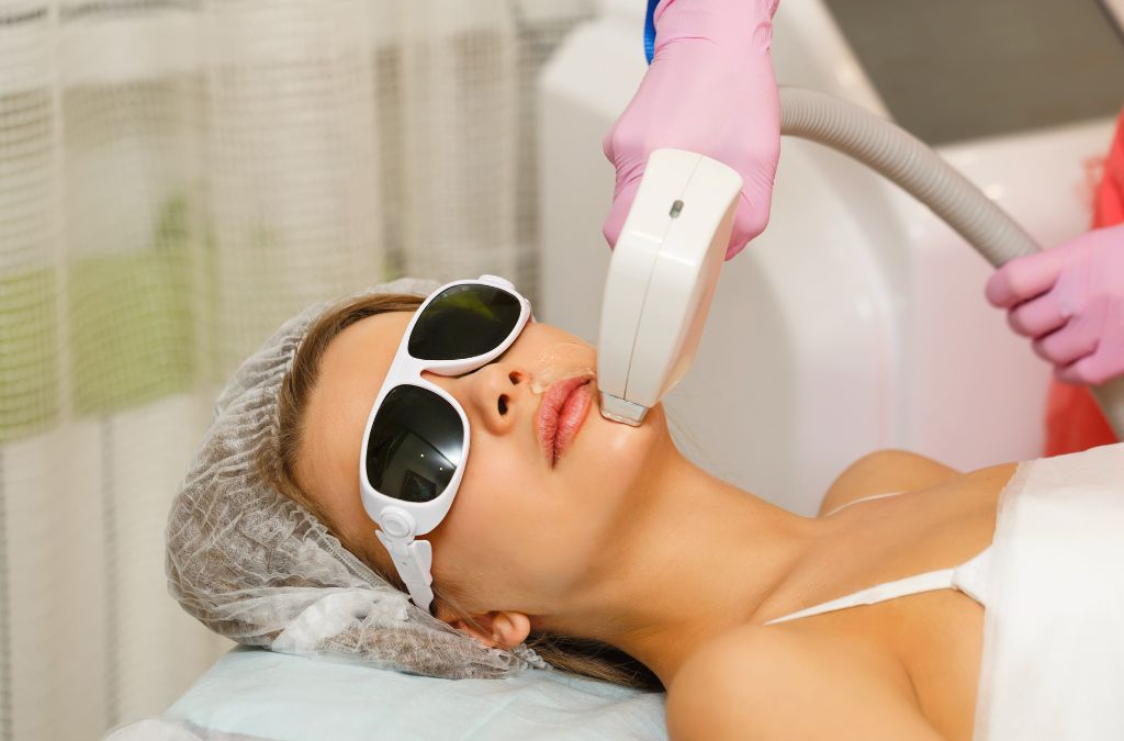 laser hair removal zones