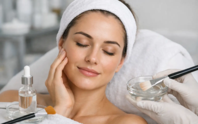 How to Prepare for Chemical Peel Treatment
