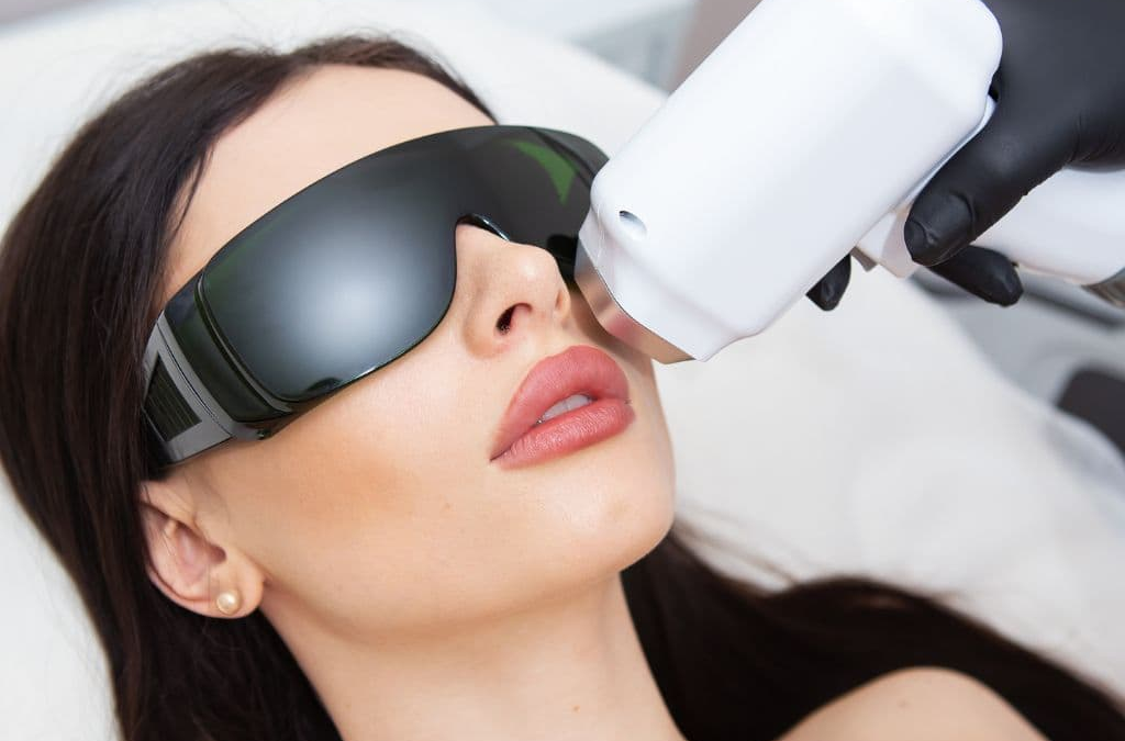 laser hair removal upper lip