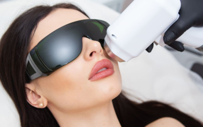 Laser hair removal upper lip, a safe and long-lasting solution