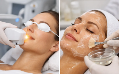 BBL vs Chemical Peel: Which Refreshes Skin Best?