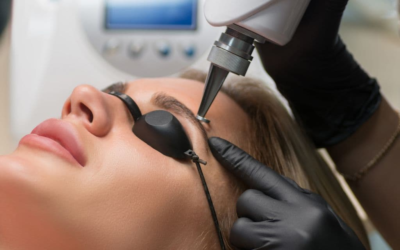 Laser hair removal eyebrows: What you should know before your treatment